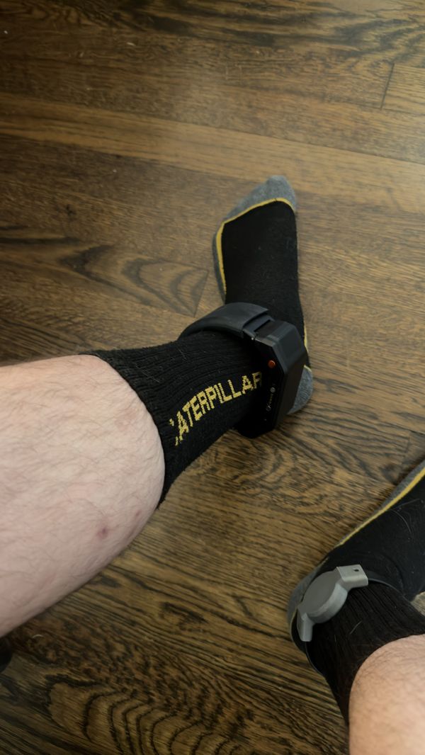Photo of an ankle monitor attached to my leg